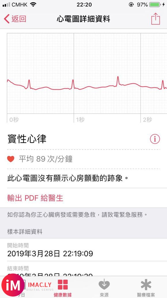 香港终於上了 买了大半年就为了ECG-2.jpg