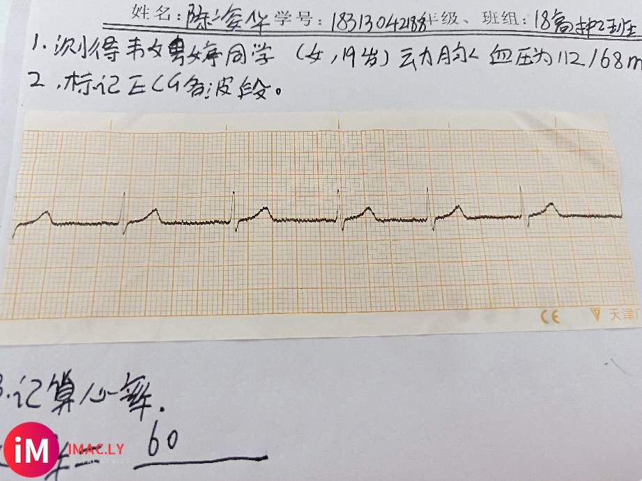 求大神帮标记一下这个心电图的ECG各波段，并帮求心...-1.jpg