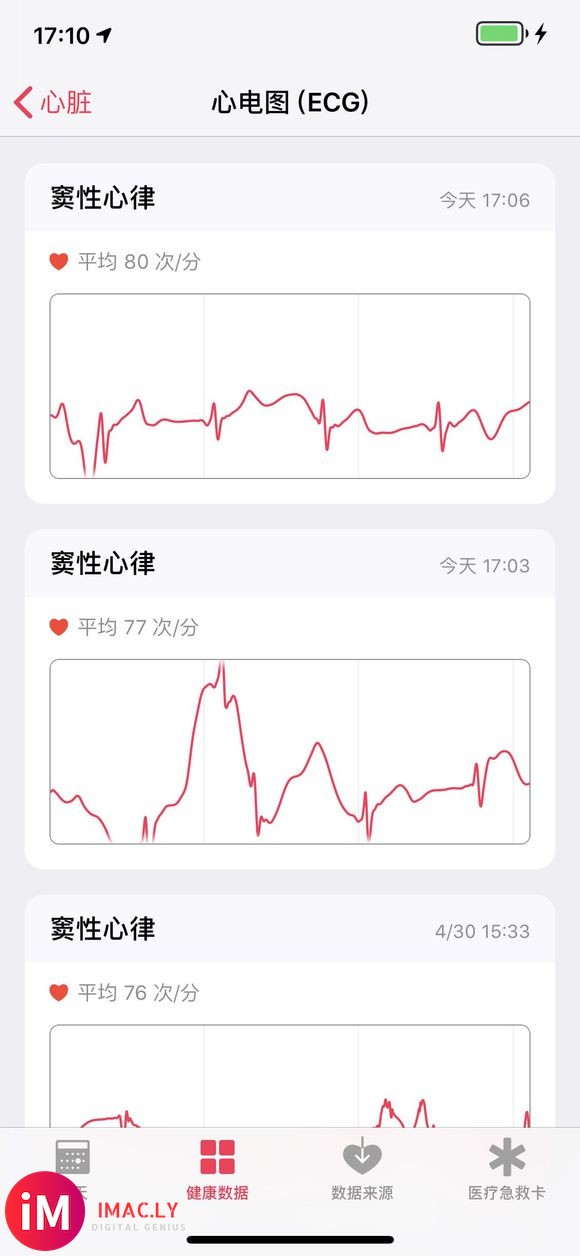 美版港版s4 成功开通心电图ecg-5.jpg