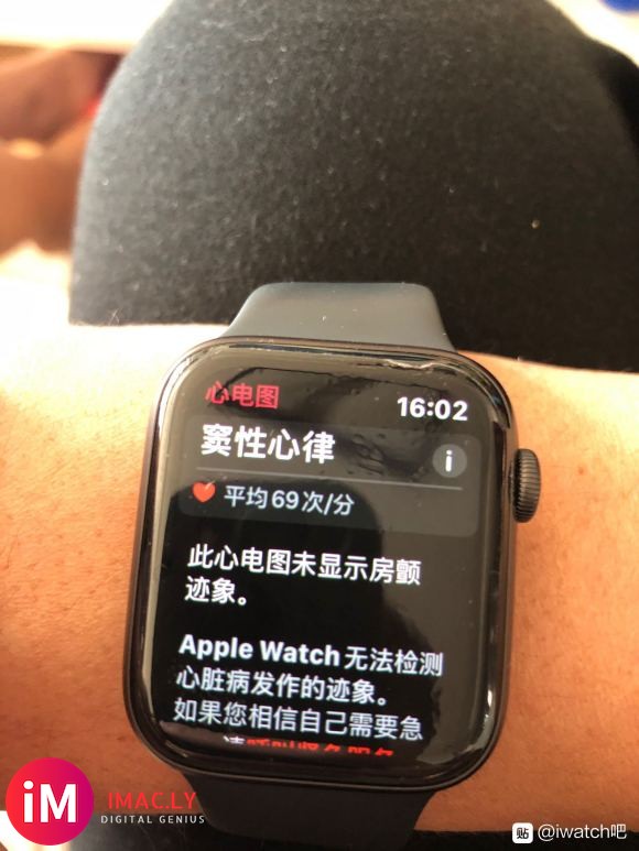 iwatch5国行成功开通ecg  心电图   很舒服  有-3.jpg