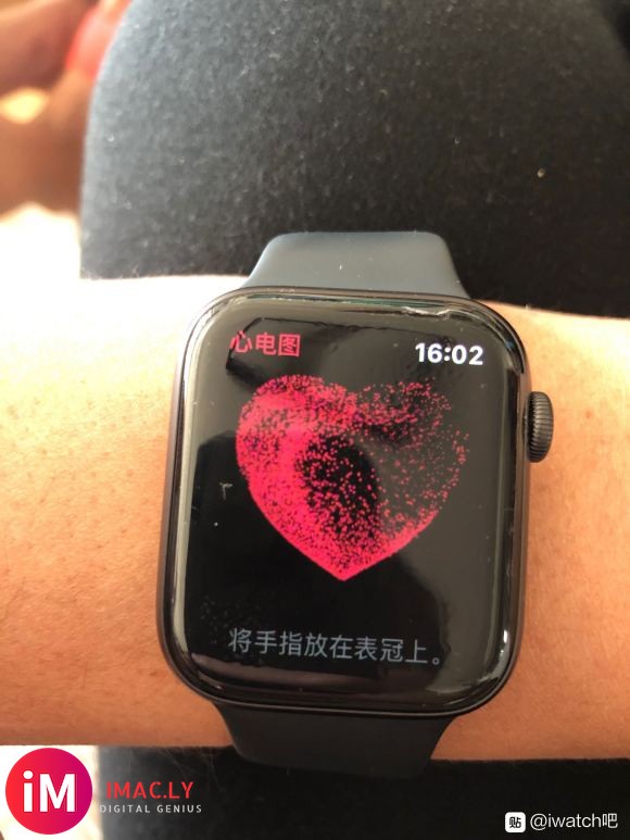 iwatch5国行成功开通ecg  心电图   很舒服  有-1.jpg