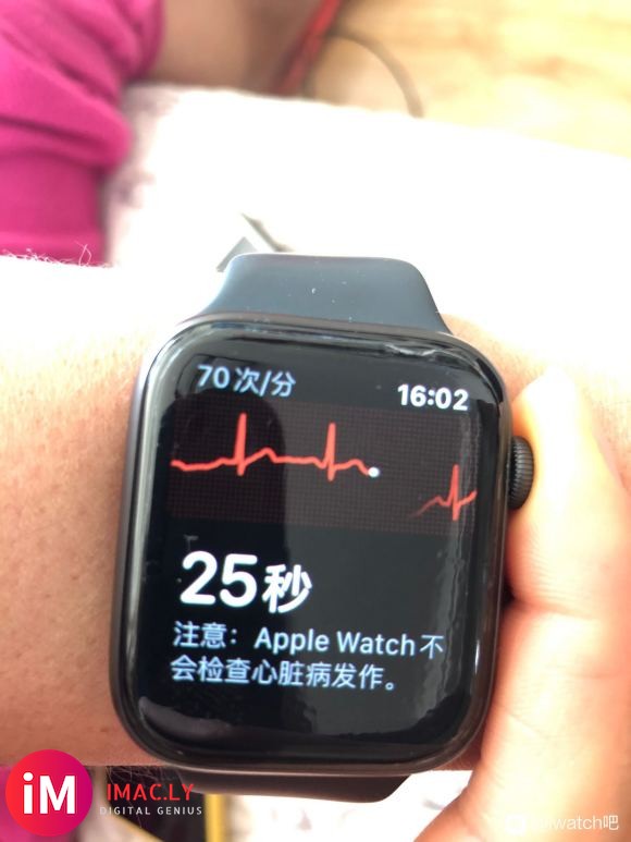 iwatch5国行成功开通ecg  心电图   很舒服  有-2.jpg