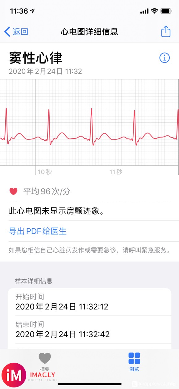 国行apple watch4开通心电图ECG成功,买来一年多-3.jpg