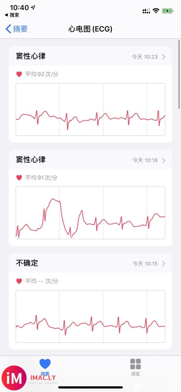 国行watch4 ecg开通成功 watchos 6.2GM-1.jpg