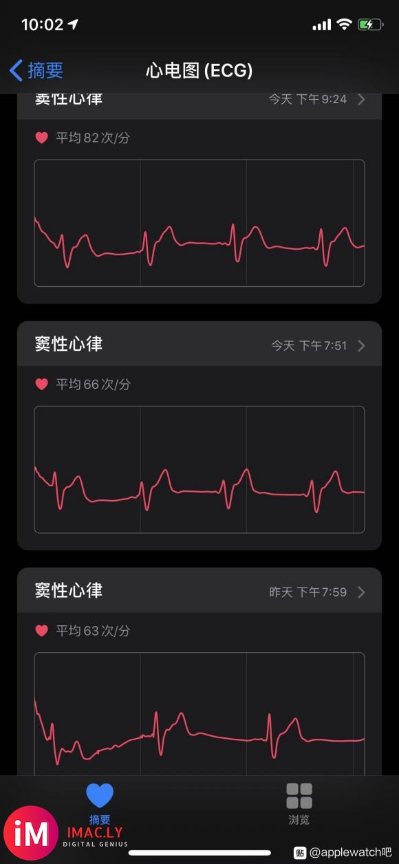 心电图(ECG)-3.jpg