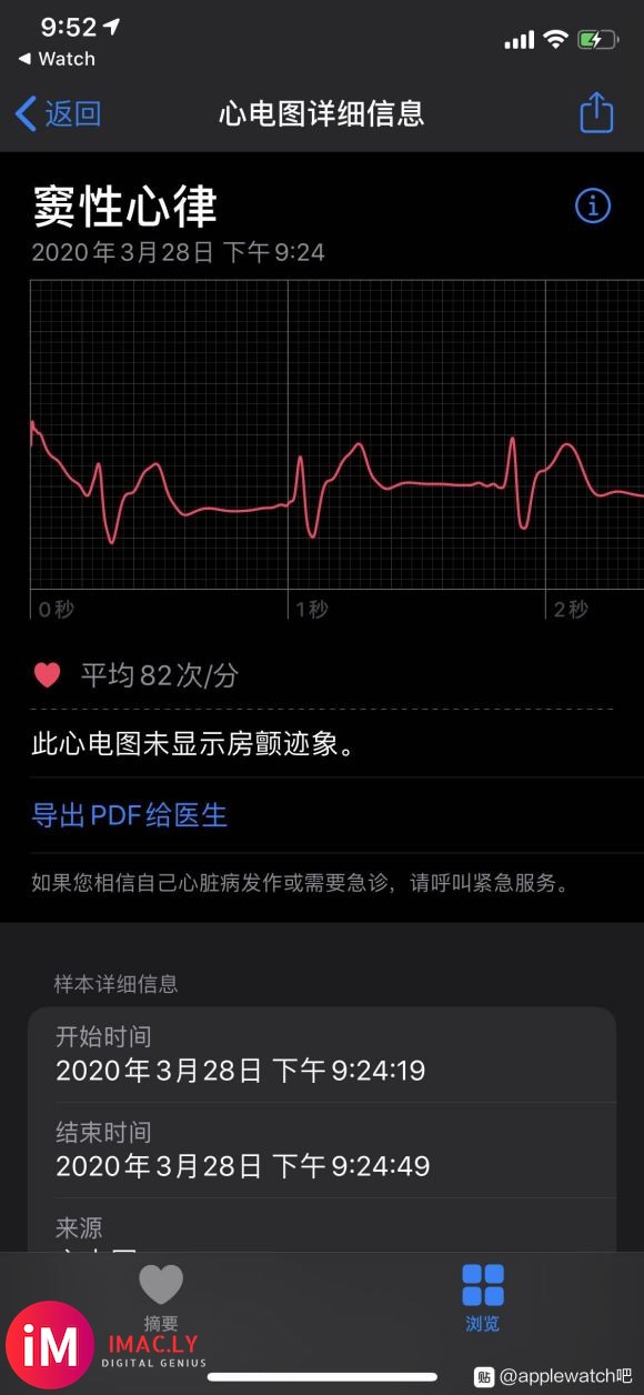 心电图(ECG)-4.jpg