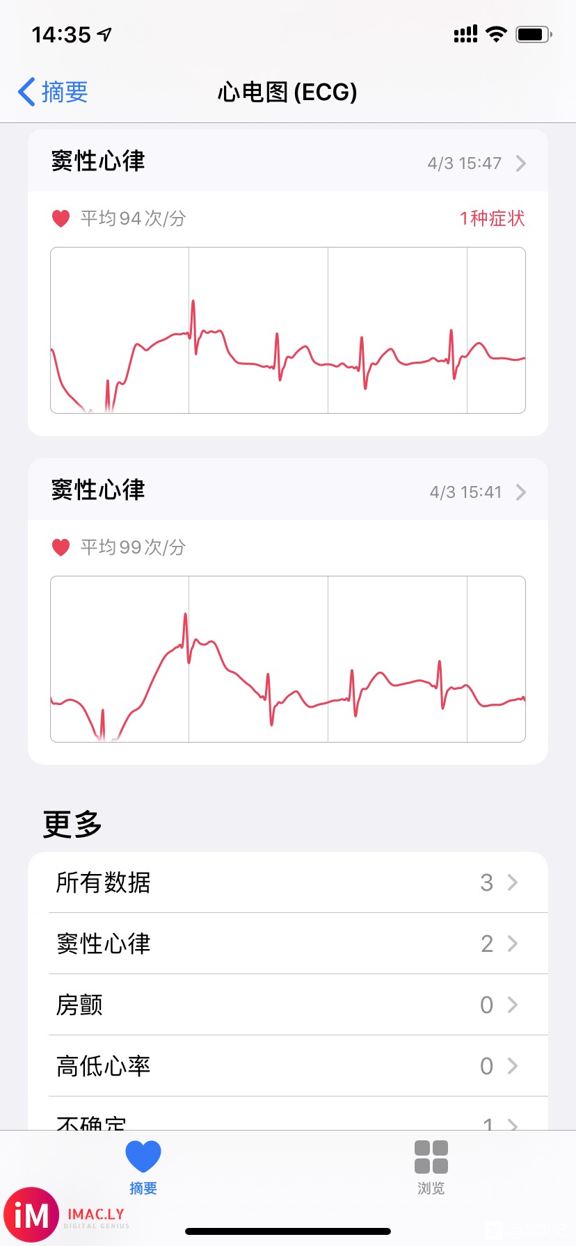 开通心电图(ECG)却同步了别人的健康数据?别急,我来帮你解-1.jpg