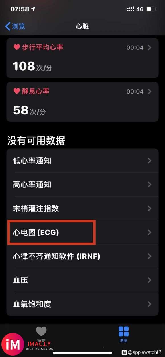 健康APP新增ECG心电图国行Apple Watch ECG-2.jpg