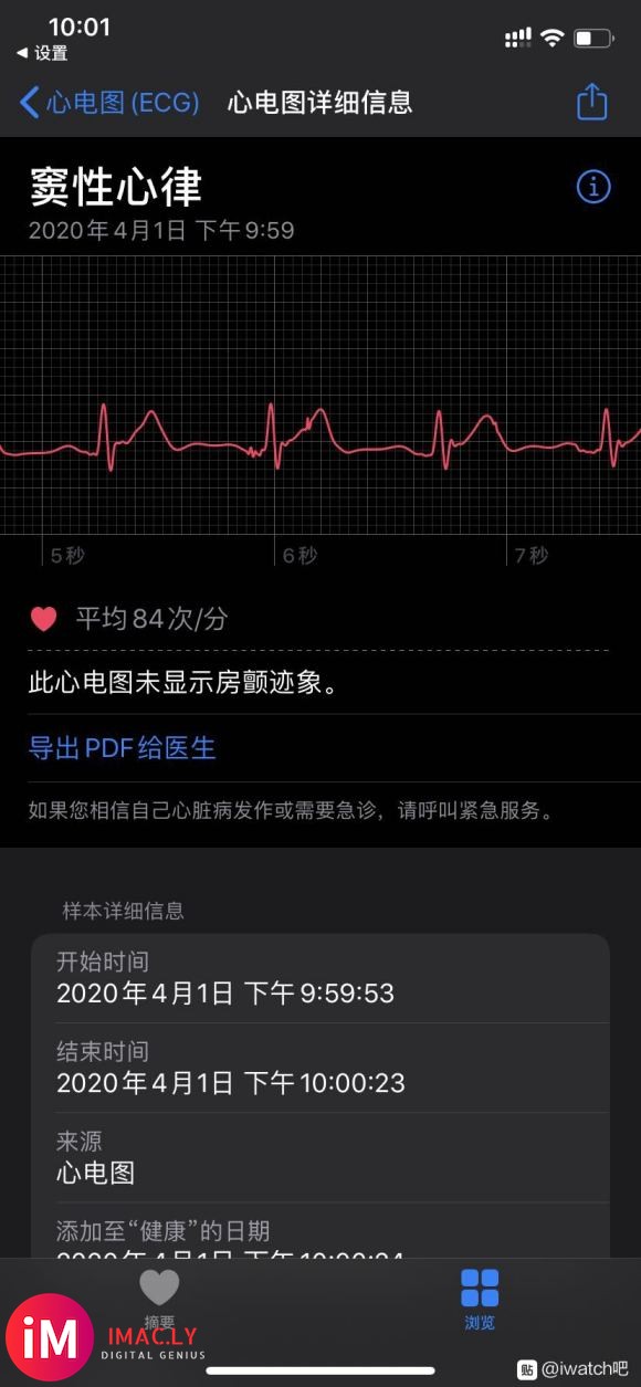 apple watch5激活心电图成功,哈哈,香啊-5.jpg