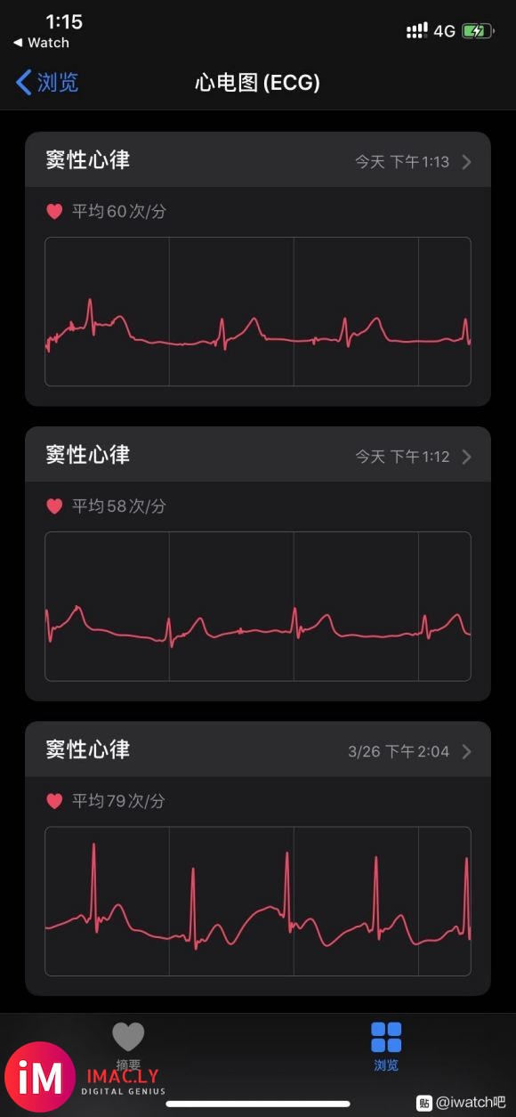 apple watch5激活心电图成功,哈哈,香啊-2.jpg