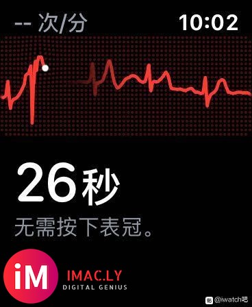 apple watch5激活心电图成功,哈哈,香啊-3.jpg