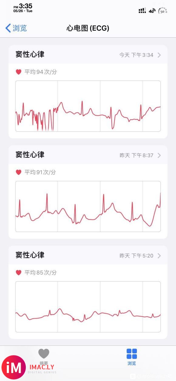 用了快2年。终于开通ECG了。这心电图看着正常吗。 大佬帮忙-1.jpg