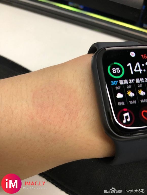 刚买的iWatch5,戴了两天,手腕有个红印子痒痒的-1.jpg