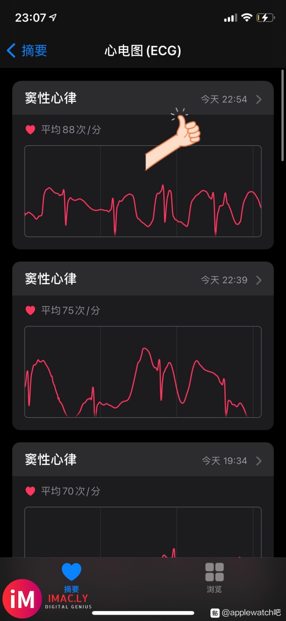 iwatch s6心电图(ECG)开通教程首先到深圳,然后到-1.jpg