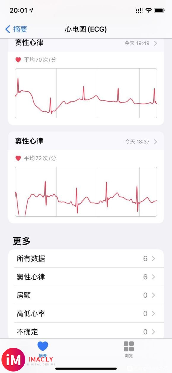 心电图开通啦,数据清理的差不多,小号也备份好了。#ECG#-1.jpg