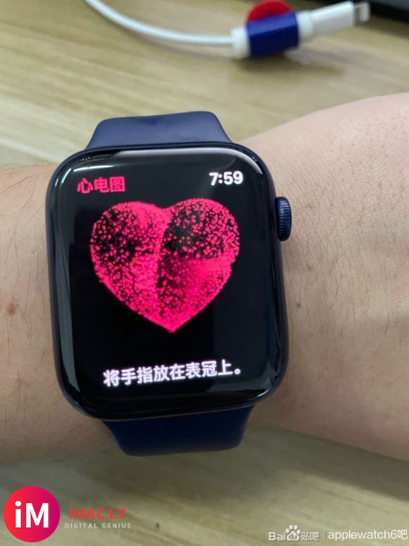 需要开通ECG(心电图)的 在我帖子留言  9.9代开 开不了包退-1.jpg