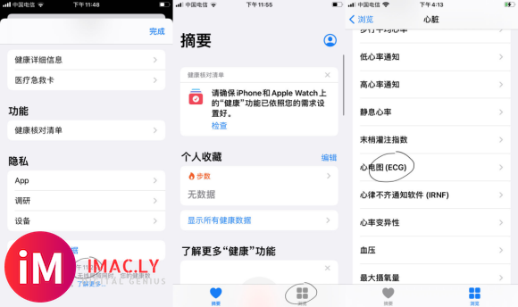 教你如何激活国行AppleWatch心电图ECG教程逐步详述-7.jpg