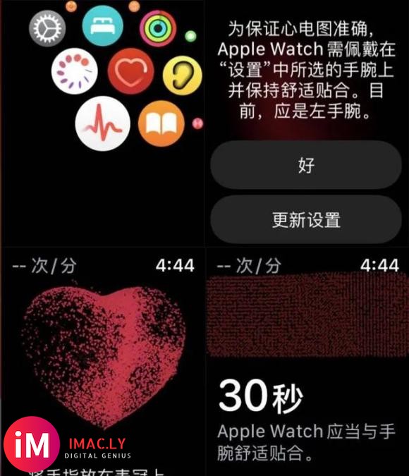 教你如何激活国行AppleWatch心电图ECG教程逐步详述-9.jpg