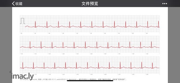 ecg出来了…-2.jpg