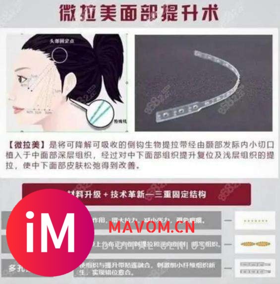 吓死了~微拉美面部提升后遗症、微拉美的危害和副作用专业解说-7.jpg